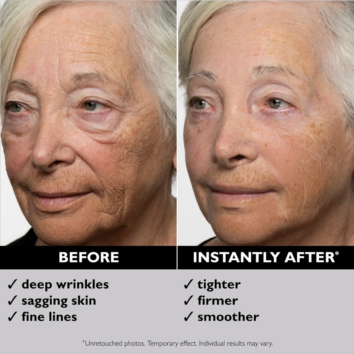 Immediate facial wrinkles and fine lines before and after comparison results after using Instant FIRMx Face Tightener