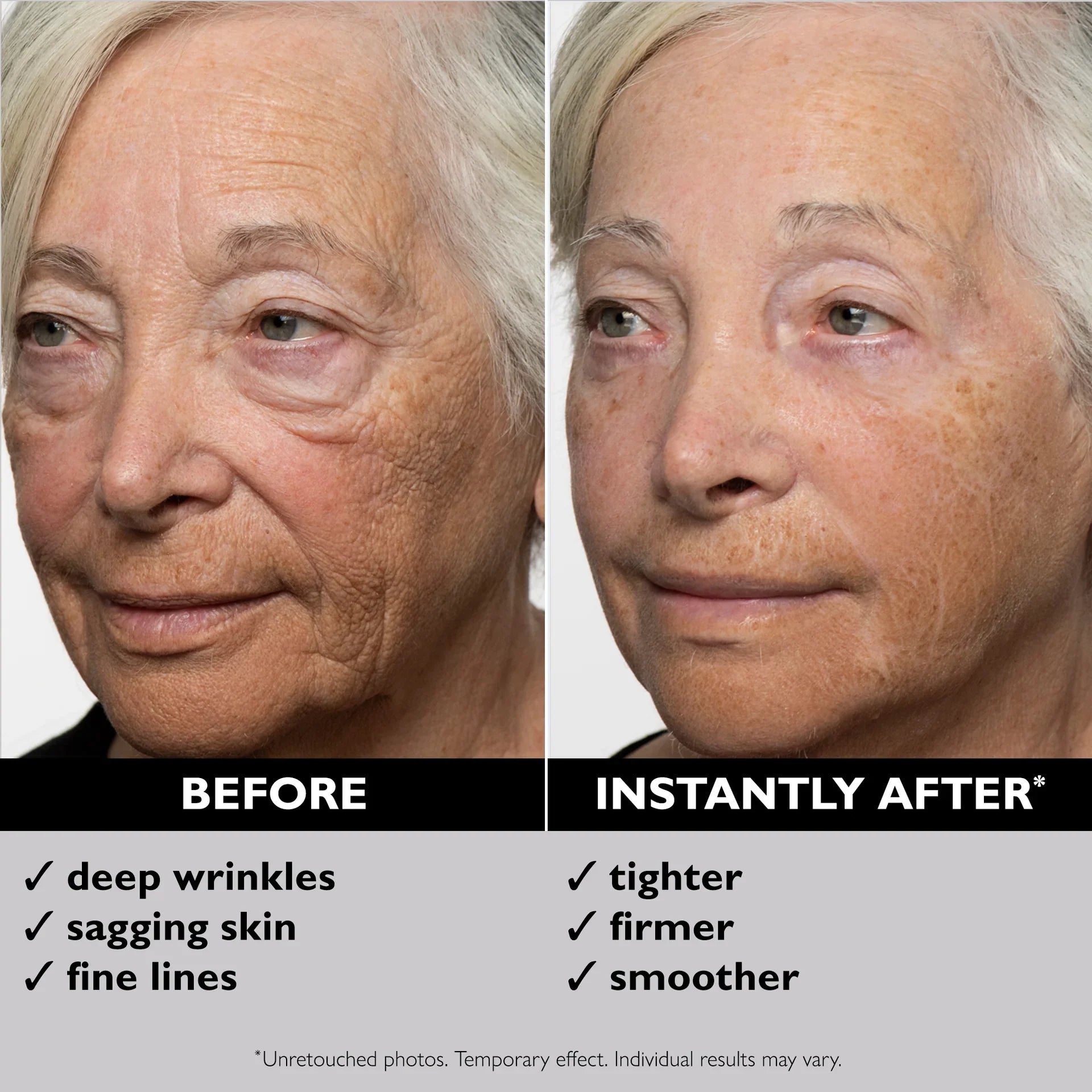Immediate facial wrinkles and fine lines before and after comparison results after using Instant FIRMx Face Tightener
