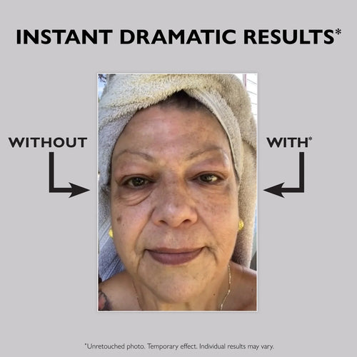 Immediate before and after comparison of under-eye bags reduction on female model