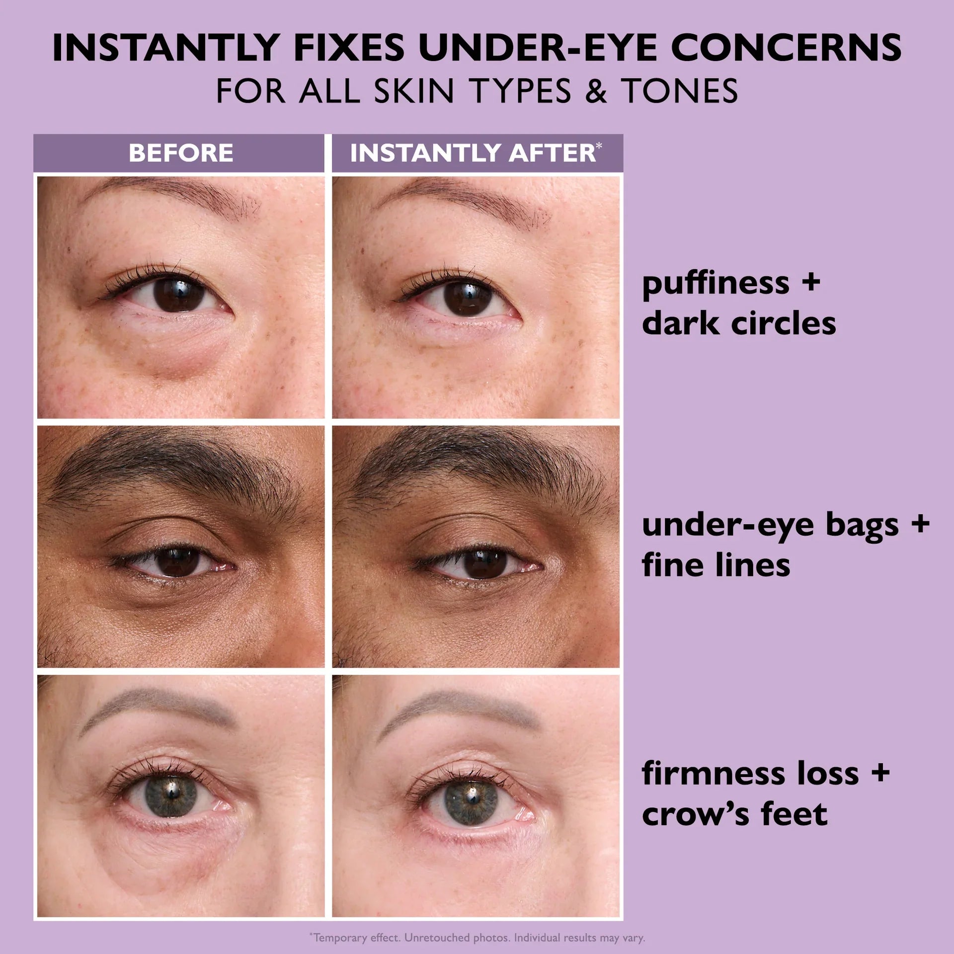Triple model before and after immediate eye firming and lifting clinical results