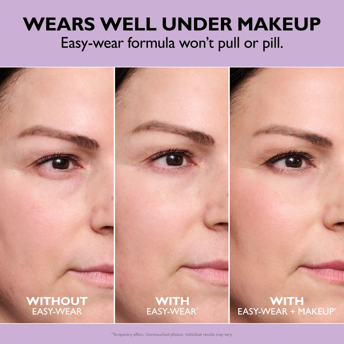 Immediate before and after under eye puffiness improvement on female model Marni